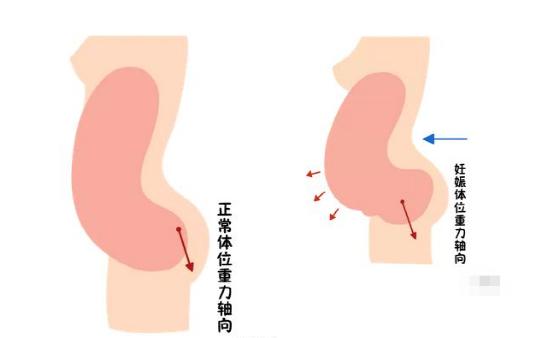 盆底恢復(fù)是否可以使用儀器？