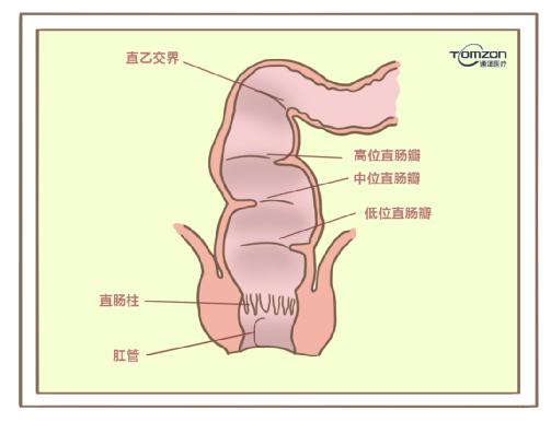 盆底康復治療儀對產(chǎn)后便秘有哪些幫助？